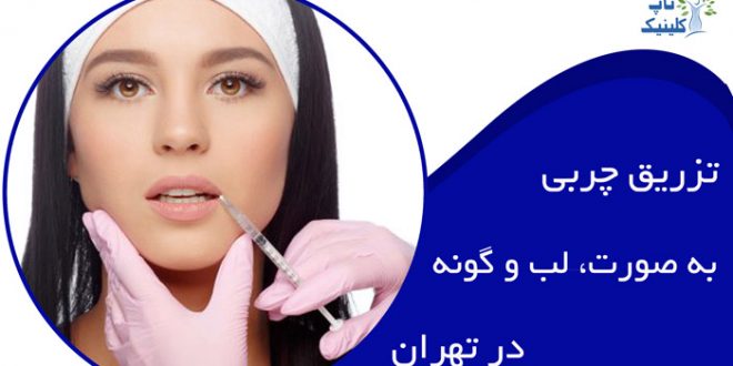 تزریق چربی به صورت در تهران